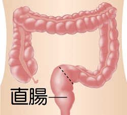 直腸