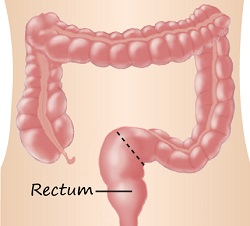 Rectum