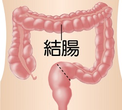 結腸