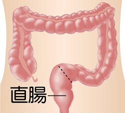 直肠 直肠